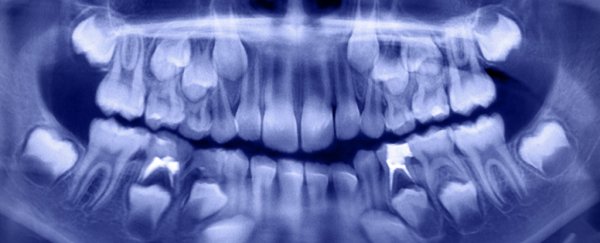Dentists pulled out more than 500 teeth from a 7-year-old boy's mouth