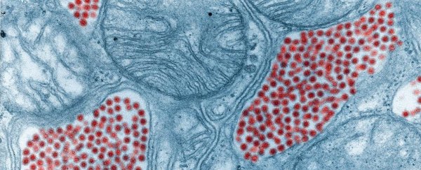 Mosquitoes have been caught carrying a deadly brain virus in Florida