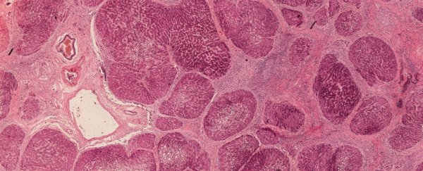Discovery of a liver 'stem cell' could one day make liver transplants redundant