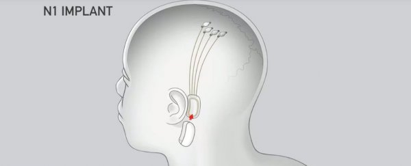 Elon Musk wants to put slightly creepy implants into people's brains next year