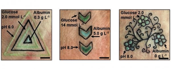 These incredible real tattoos change colour as biomarkers like glucose levels shift