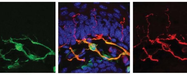 Scientists just discovered a previously unknown pain-detecting organ in mammals