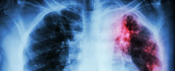 The deadliest type of tuberculosis has a new FDA-approved treatment