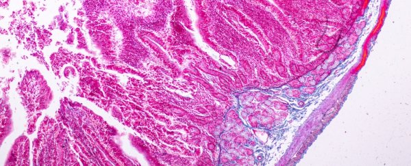 We just got closer to a simple blood test that can actually diagnose celiac disease