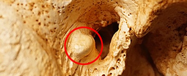 Bones reveal that Neanderthals were prone to surfer's ear, but nobody knows why