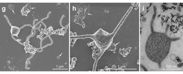 Primordial 'Asgard' lifeform has been successfully grown in the lab