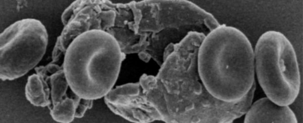 Researchers find bone-like particles travelling in the human bloodstream
