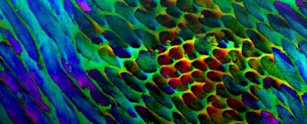 Newly found structures in tooth enamel might finally explain its bizarre strength