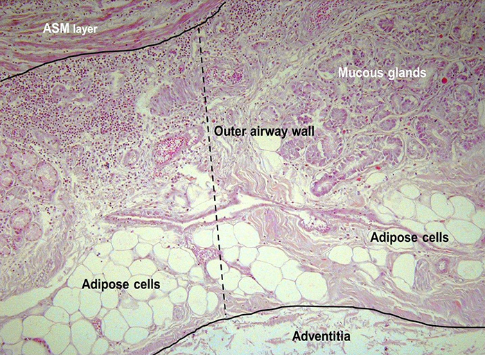 fatty tissue 2