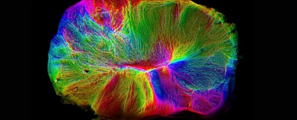 We are 'perilously close' to creating sentient mini-brains in a dish, experts warn
