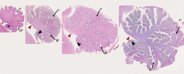 World-first discovery hints why brain studies in mice don't always translate to humans