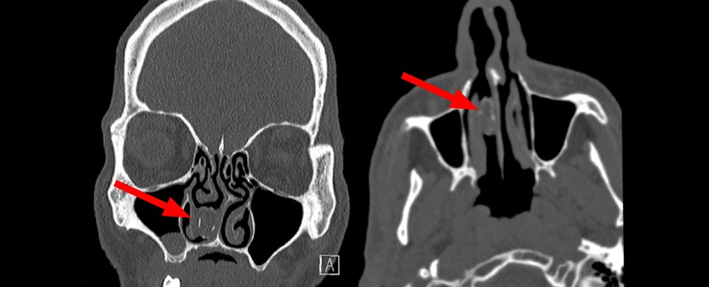 main article image