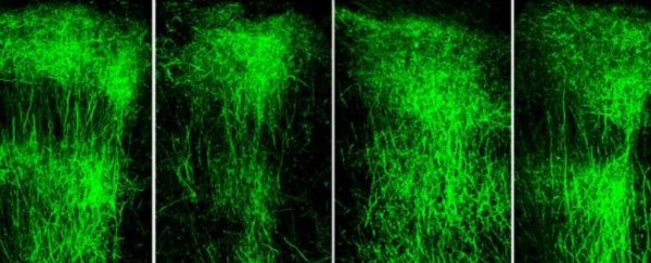 Surprise result in experiment with mice reverses core symptom of schizophrenia