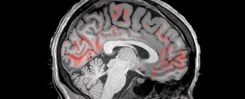 Mesmerising Video Shows Waves of Spinal Fluid Washing Over The Brain During  Sleep