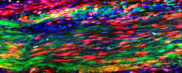 Discovery of elusive tendon stem cells in mice 'could be  a game-changer' for healing