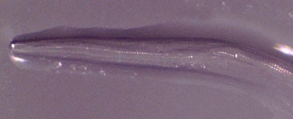 Woman finds parasitic worms in her eyes after running through a swarm of flies