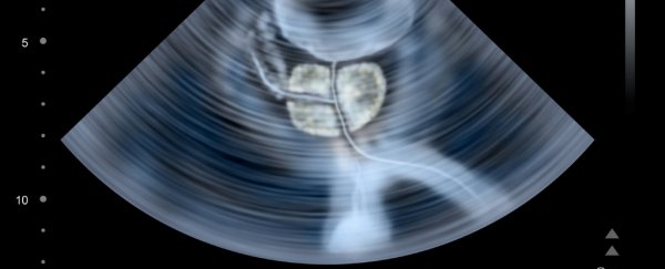 Researchers say the BRCA2 gene fault isn't only a cancer risk for women