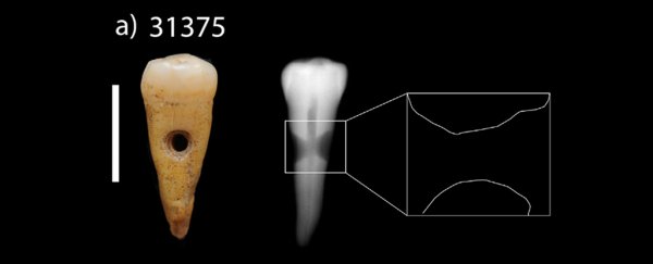 Neolithic people in the Near East made jewellery out of human teeth