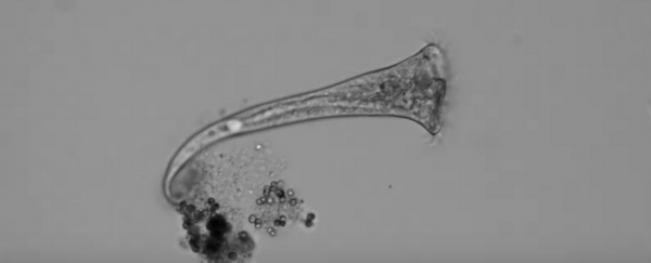 This single-celled animal makes complex 'decisions' even without a nervous system