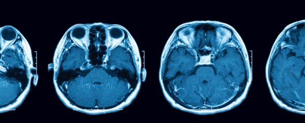Bizarre study finds women on the pill have a smaller hypothalamus, but does it matter?