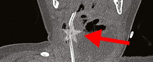 Terrifying medical case shows why you should be wary of confetti stars this Christmas