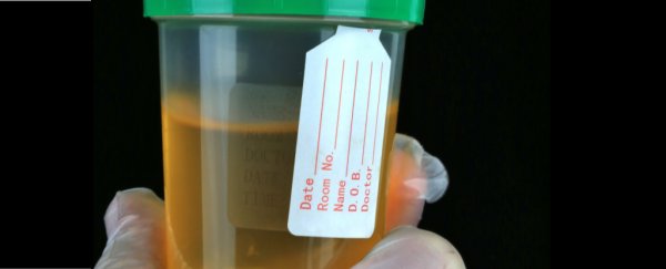 Here's why too much exercise too fast can cause real damage and turn your urine brown