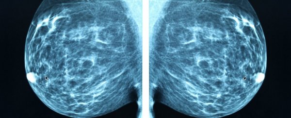 AI is now officially better at diagnosing breast cancer than human experts