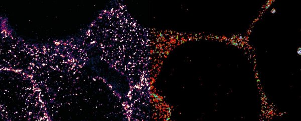 We just got an unprecedented look at a crucial component of type 2 diabetes