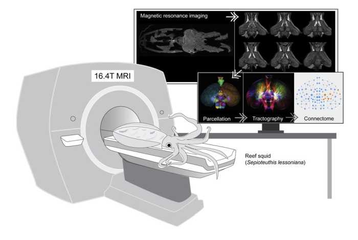 squid mri