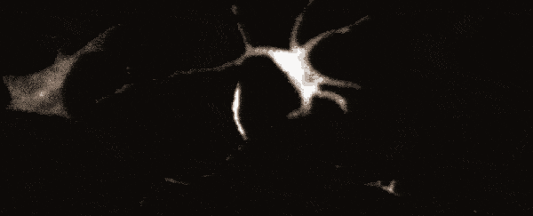Strange neuron-like bursts have been detected in skin cells for the first time