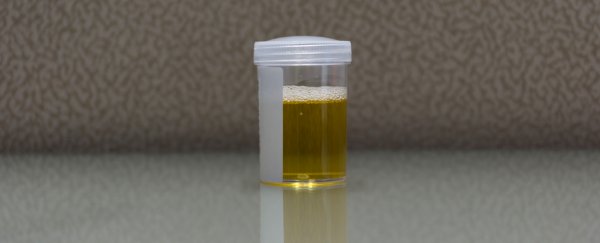 Doctors have reported an extremely rare case of a person who urinates alcohol
