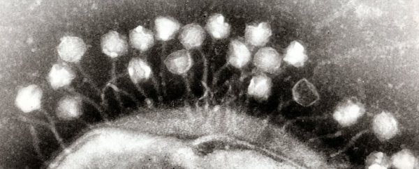 Scientists discover giant viruses with features only seen before in living cells