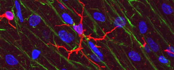 Mouse experiment shows common immune cells in the brain may play key role in memory
