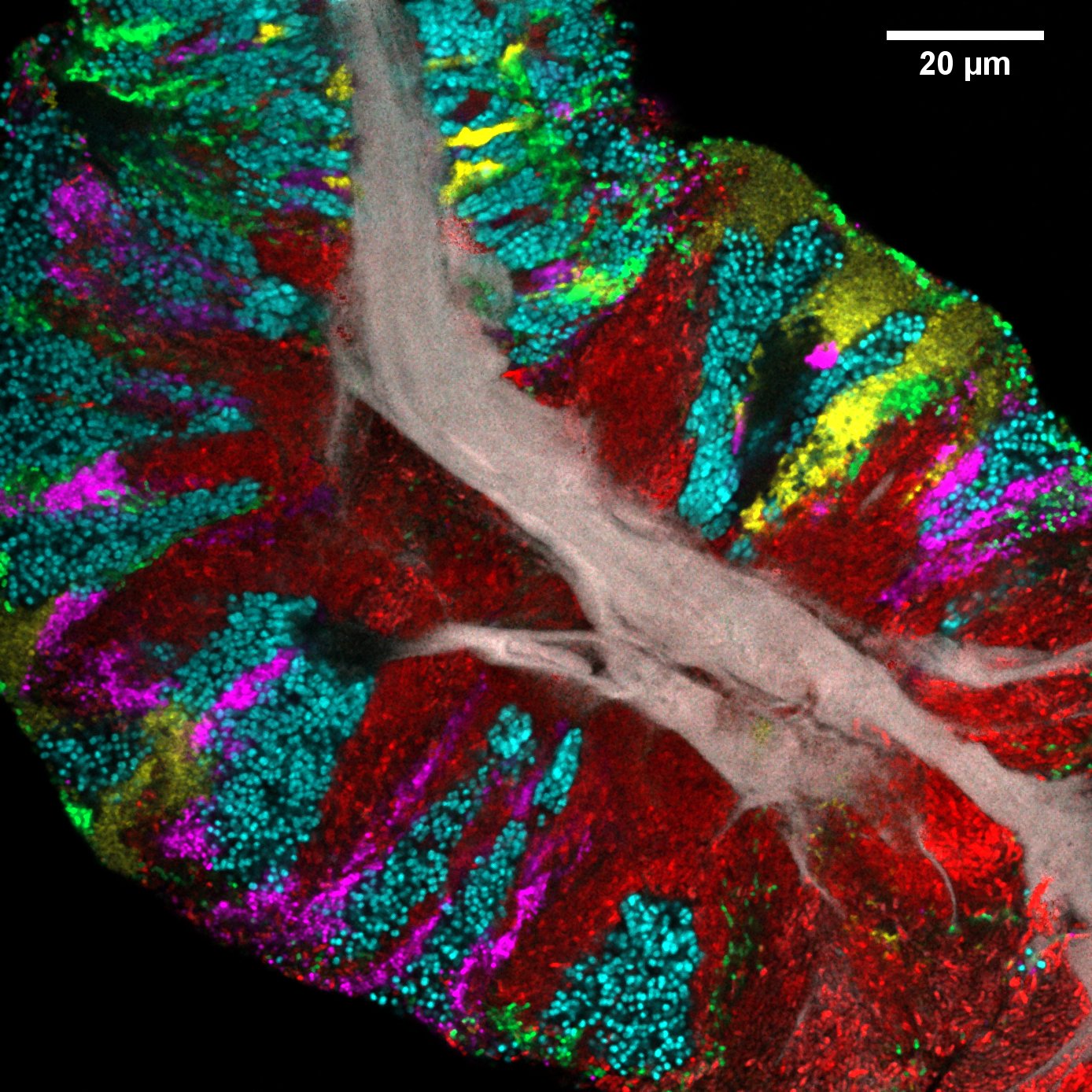 Each sample of dead tongue epithelial cells (grey) is surrounded by communities of bacteria. (Steven Wilbert/Gary Borisy/The Forsyth Institute)