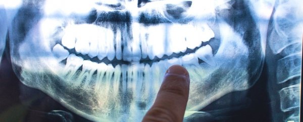 Eerie 'tree ring' lines in our teeth could indicate life events, including childbirth