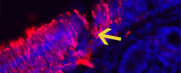 Thriving 'neuron nurseries' have been found inside the adult human nose
