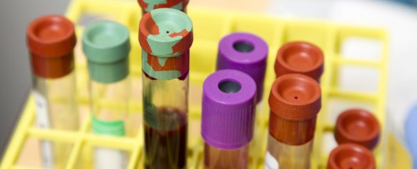 Some blood types may be slightly more susceptible to COVID-19, paper suggests