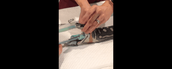 Vets in Australia had to pull an entire beach towel out of a python's stomach