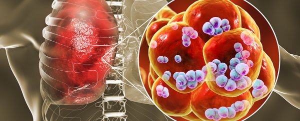 What is pneumonia?