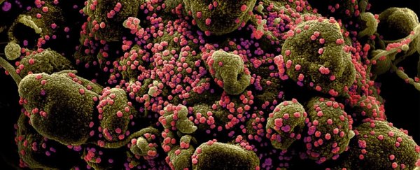 Virologist explains what the coronavirus does to your body that makes it so deadly