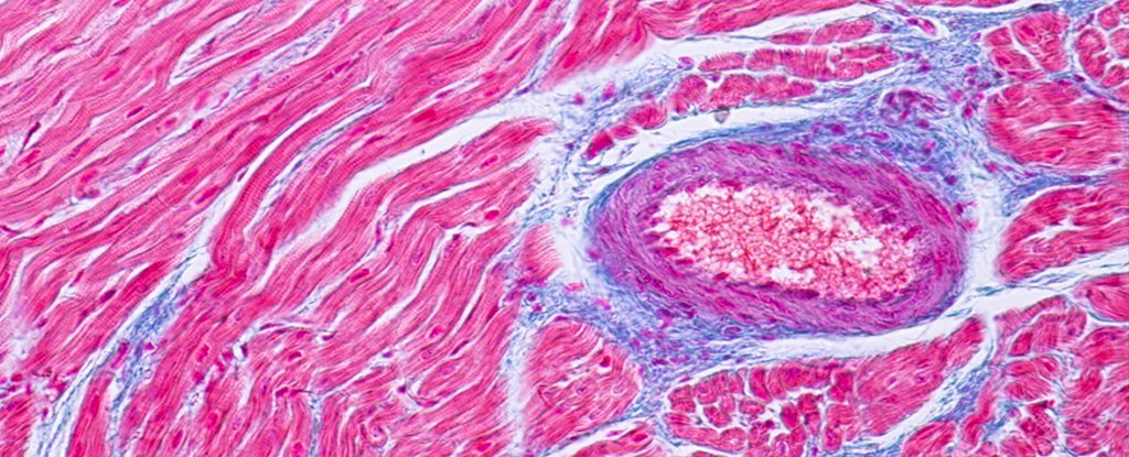 Heart muscles, like these, can be inflamed by the infection. 