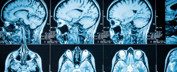 Coronavirus patients are reporting neurological symptoms. Here's what you need to know