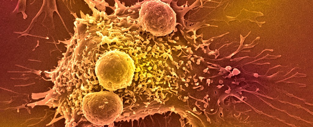La nueva prueba de sangre con IA promete una detección fácil de más de 50 tipos de cáncer 59 La nueva prueba de sangre con IA promete una detección fácil de más de 50 tipos de cáncer 51
