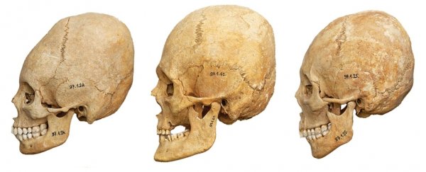 This Hungarian village welcomed skull-shaping immigrants as the Roman Empire crumbled