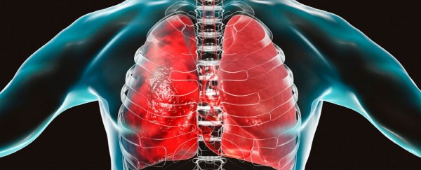 Men could be more vulnerable to the coronavirus due to a lung enzyme, study says