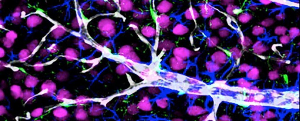 One Gene Is a Major Risk Factor For Alzheimer's Disease, And We May Finally Know Why 4 One Gene Is a Major Risk Factor For Alzheimer's Disease, And We May Finally Know Why 1