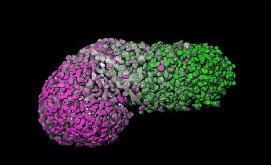 Image analysis showing the cell gradient between head (magenta) and 'tail' end (green), with grey marking DNA. (Naomi Moris/University of Cambridge)