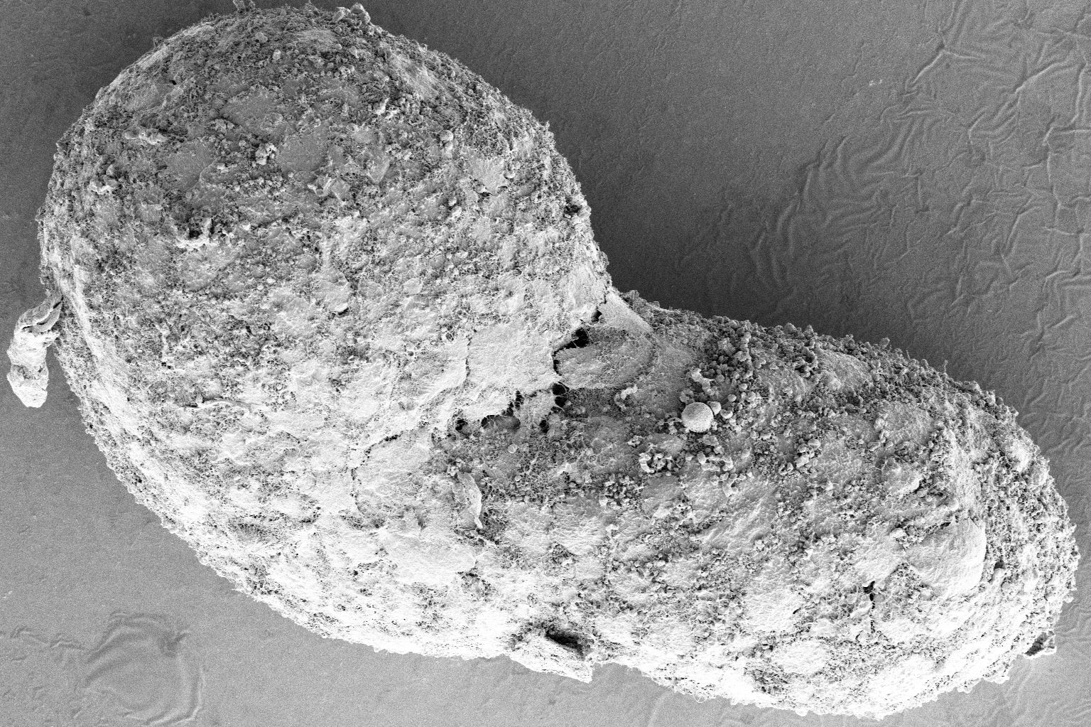 Scanning electron micrograph of the human gastruloid at 72 hours. (Naomi Moris/University of Cambridge)