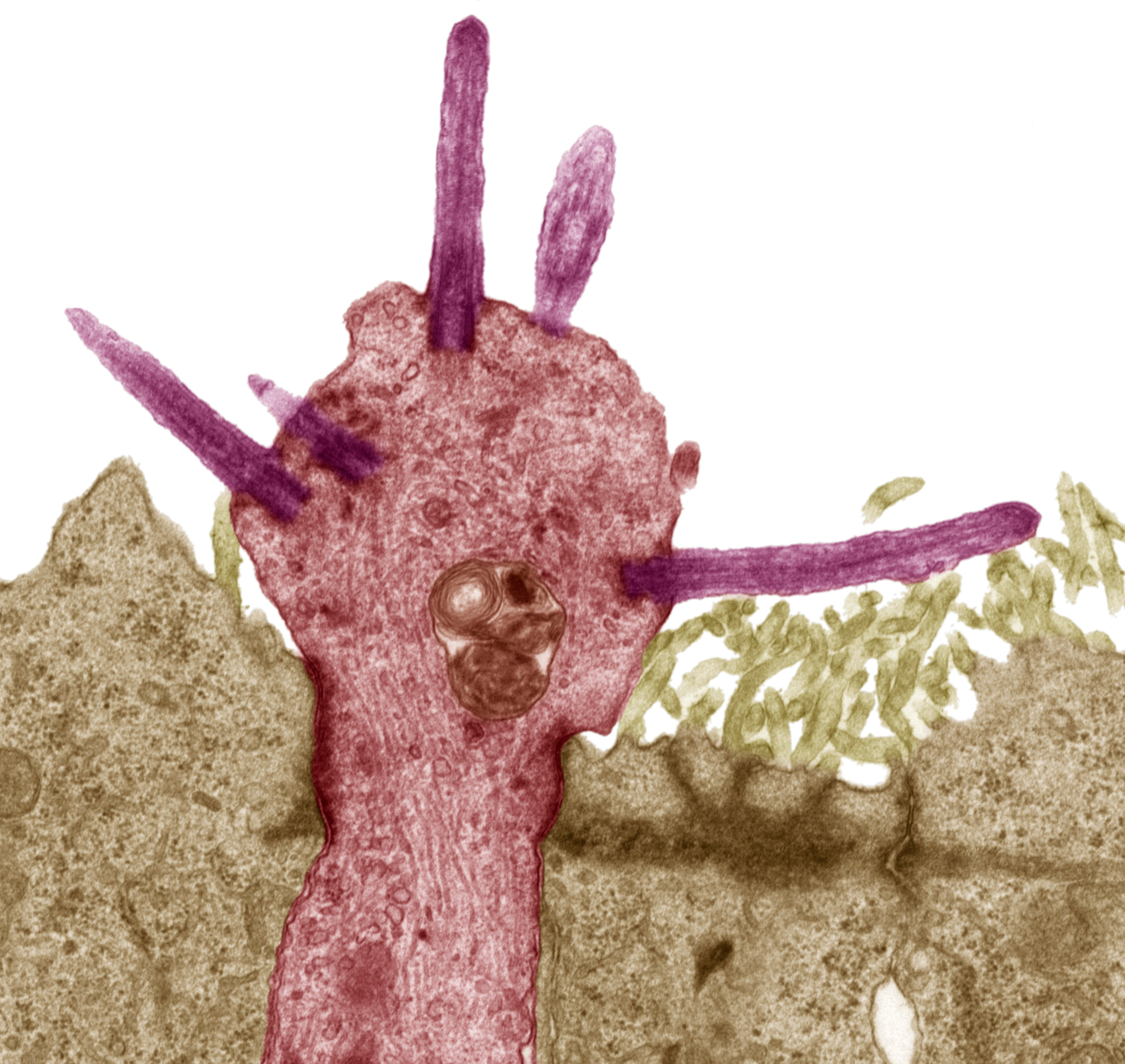 Micrograph of olfactory neuron (pink) with protruding smell receptors (cilia). (xxx)