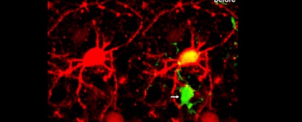 For the first time, scientists have captured video of brains clearing out dead neurons